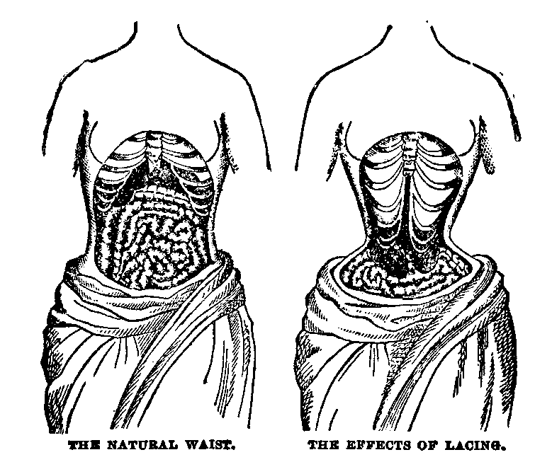 Corsets - “Women must be submissive. Indeed what could most woremen do? Who  had they to maintain them, but their husbands?”